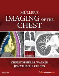 E-book Muller'S Imaging Of The Chest E-Book