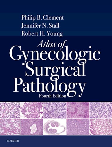 E-book Atlas of Gynecologic Surgical Pathology E-Book