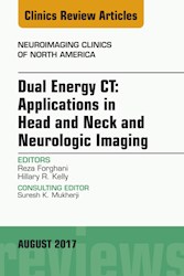 E-book Dual Energy Ct: Applications In Head And Neck And Neurologic Imaging, An Issue Of Neuroimaging Clinics Of North America