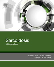E-book Sarcoidosis