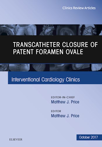 E-book Transcatheter Closure of Patent Foramen Ovale, An Issue of Interventional Cardiology Clinics