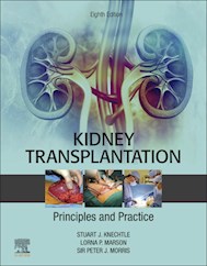 E-book Kidney Transplantation - Principles And Practice