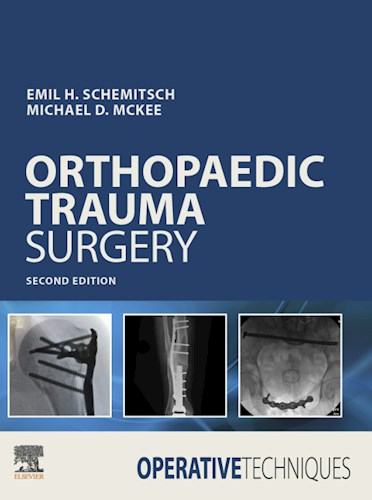 E-book Operative Techniques: Orthopaedic Trauma Surgery