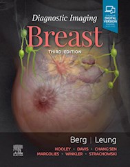 E-book Diagnostic Imaging: Breast