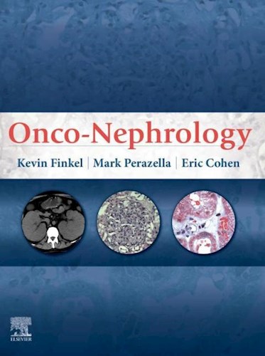 E-book Onco-Nephrology