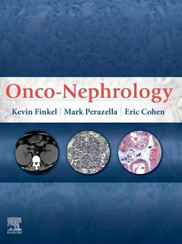  Onco-Nephrology