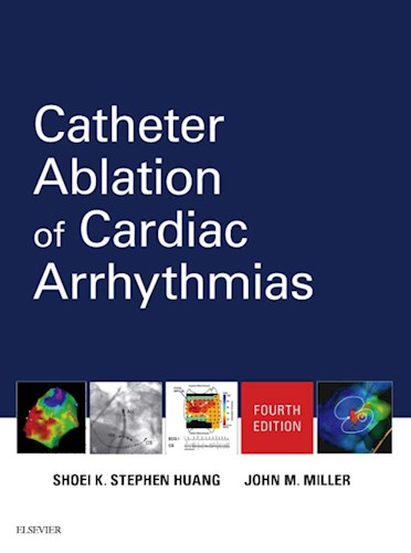 E-book Catheter Ablation of Cardiac Arrhythmias