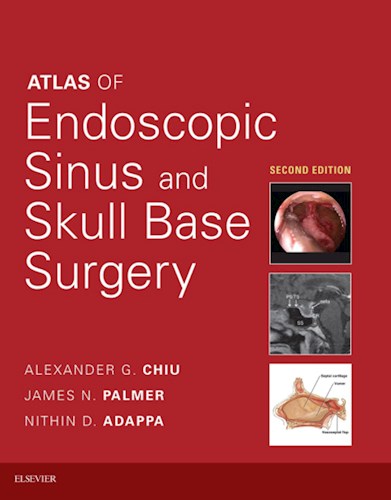 Atlas of Endoscopic Sinus and Skull Base Surgery por Alexander G