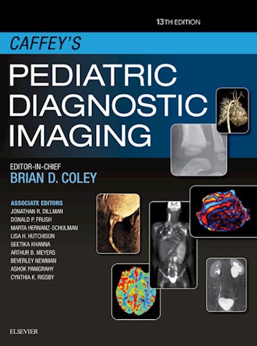 E-book Caffey's Pediatric Diagnostic Imaging