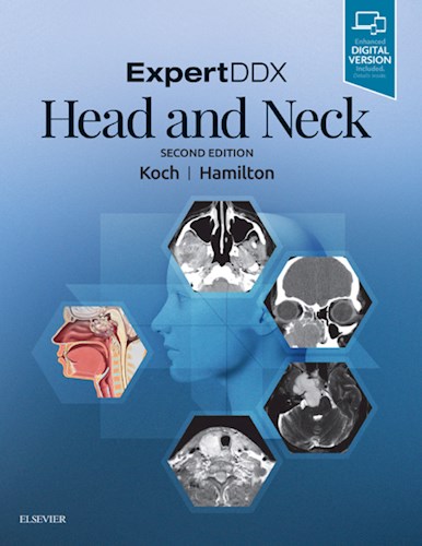 E-book ExpertDDX: Head and Neck