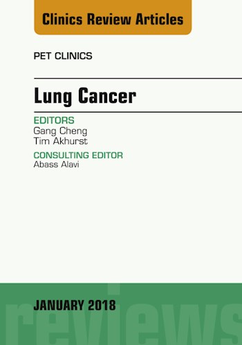 E-book Lung Cancer, An Issue of PET Clinics
