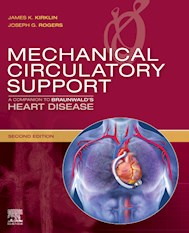 E-book Mechanical Circulatory Support
