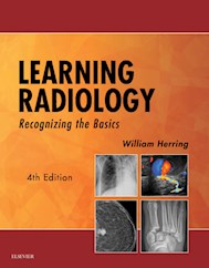 E-book Learning Radiology