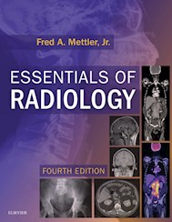 E-book Essentials Of Radiology