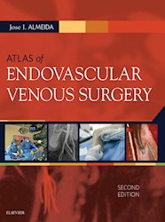E-book Atlas Of Endovascular Venous Surgery