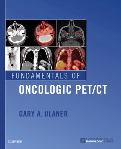 E-book Fundamentals of Oncologic PET/CT