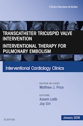 E-book Transcatheter Tricuspid Valve Intervention / Interventional Therapy For Pulmonary Embolism, An Issue Of Interventional Cardiology Clinics