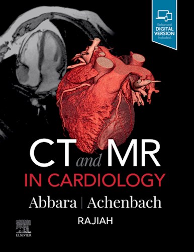 E-book CT and MR in Cardiology (eBook)