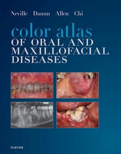 E-book Color Atlas of Oral and Maxillofacial Diseases