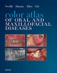 E-book Color Atlas Of Oral And Maxillofacial Diseases