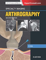 E-book Specialty Imaging: Arthrography