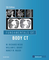 E-book Fundamentals Of Body Ct E-Book