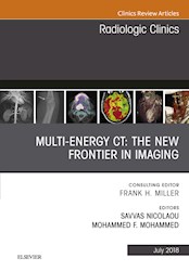E-book Multi-Energy Ct: The New Frontier In Imaging, An Issue Of Radiologic Clinics Of North America