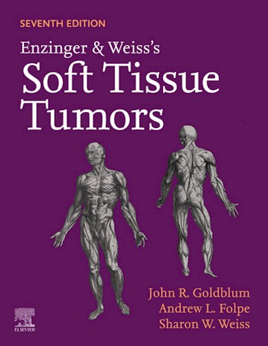 E-book Enzinger and Weiss's Soft Tissue Tumors