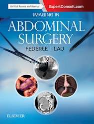 E-book Imaging In Abdominal Surgery