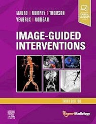 Papel Image-Guided Interventions Ed.3