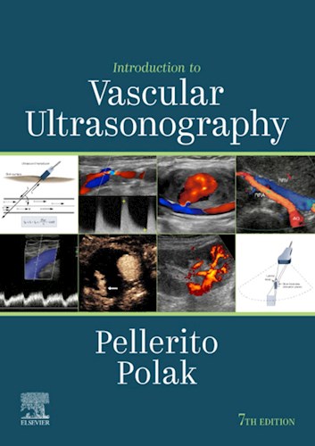 E-book Introduction to Vascular Ultrasonography (eBook)
