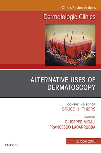 E-book Alternative Uses of Dermatoscopy, An Issue of Dermatologic Clinics