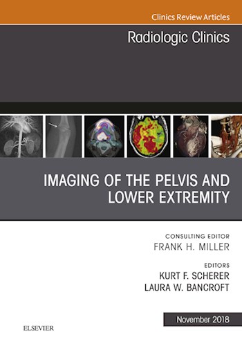 E-book Imaging of the Pelvis and Lower Extremity, An Issue of Radiologic Clinics of North America