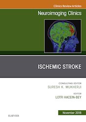 E-book Ischemic Stroke, An Issue Of Neuroimaging Clinics Of North America