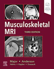E-book Musculoskeletal Mri