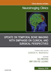 E-book Temporal Bone Imaging: Clinicoradiologic And Surgical Considerations, An Issue Of Neuroimaging Clinics Of North America