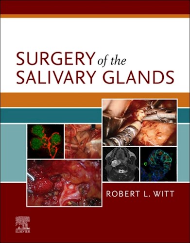  Surgery Of The Salivary Glands E-Book