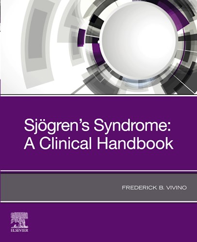 E-book Sjogren's Syndrome