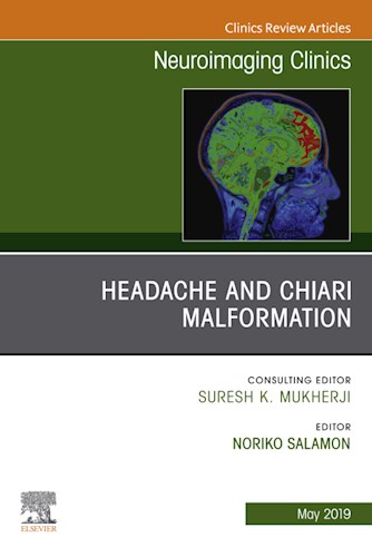 E-book Headache and Chiari Malformation, An Issue of Neuroimaging Clinics of North America