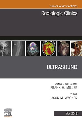  Ultrasound  An Issue Of Radiologic Clinics Of North America