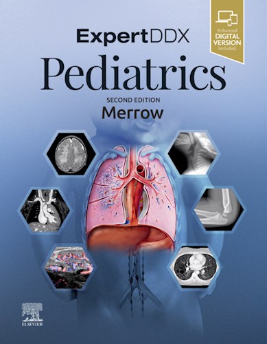  Expertddx  Pediatrics