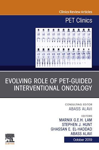 E-book Evolving Role of PET-guided Interventional Oncology, An Issue of PET Clinics