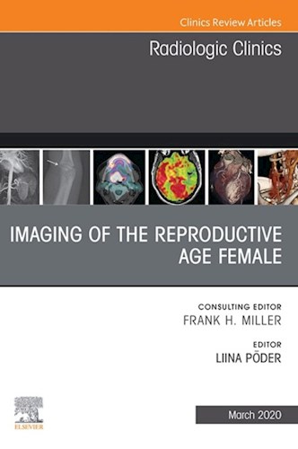  Imaging Of The Reproductive Age Female An Issue Of Radiologic Clinics Of North America E-Book