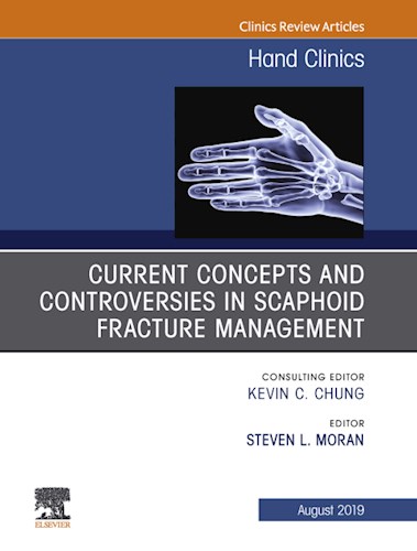 E-book Current Concepts and Controversies in Scaphoid Fracture Management, An Issue of Hand Clinics