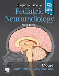E-book Diagnostic Imaging: Pediatric Neuroradiology
