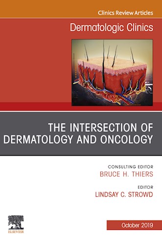 E-book The Intersection of Dermatology and Oncology, An Issue of Dermatologic Clinics