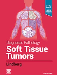 E-book Diagnostic Pathology: Soft Tissue Tumors