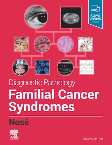 E-book Diagnostic Pathology: Familial Cancer Syndromes