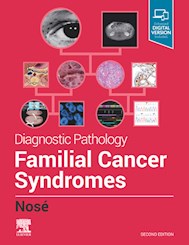 E-book Diagnostic Pathology: Familial Cancer Syndromes E-Book
