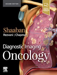 E-book Diagnostic Imaging: Oncology